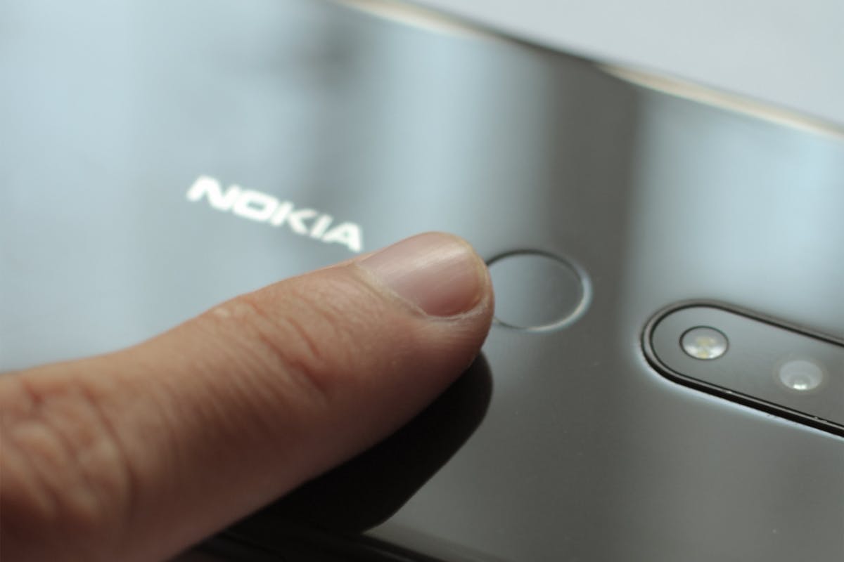 Nokia Streaming Box 8010 - Installation und Erfahrungen